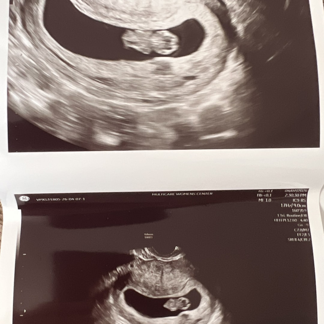 Photo shared by Christina for their Babylist baby registry.