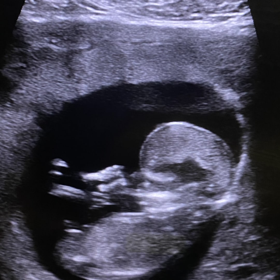 Photo shared by Lauren for their Babylist baby registry.