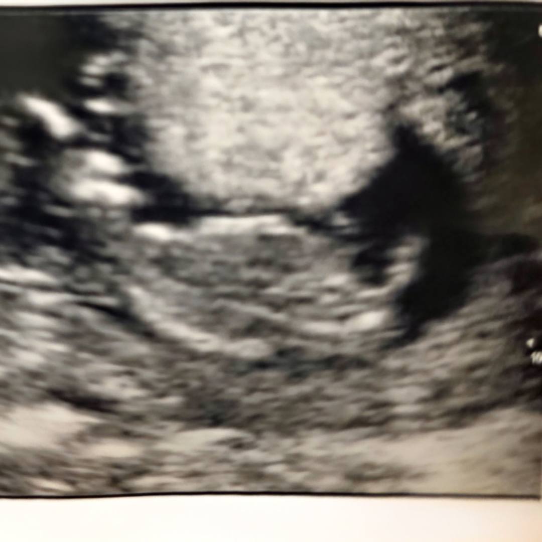 Photo shared by Angel for their Babylist baby registry.
