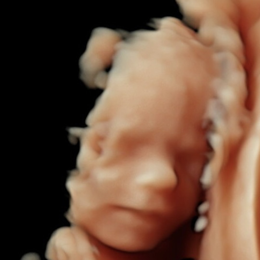 Photo shared by Josette for their Babylist baby registry.