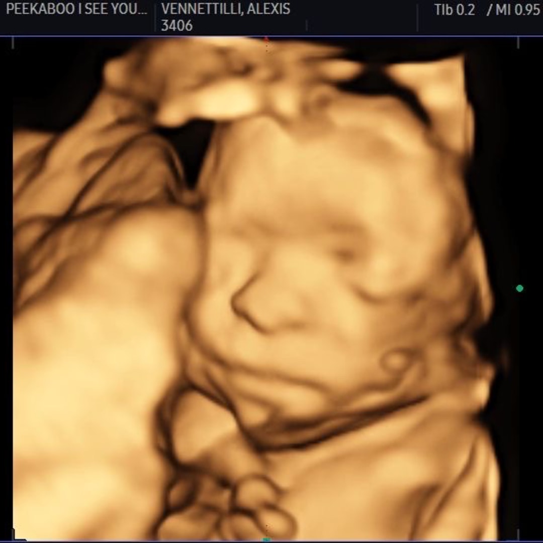 Photo shared by Alexis & Patrick for their Babylist baby registry.