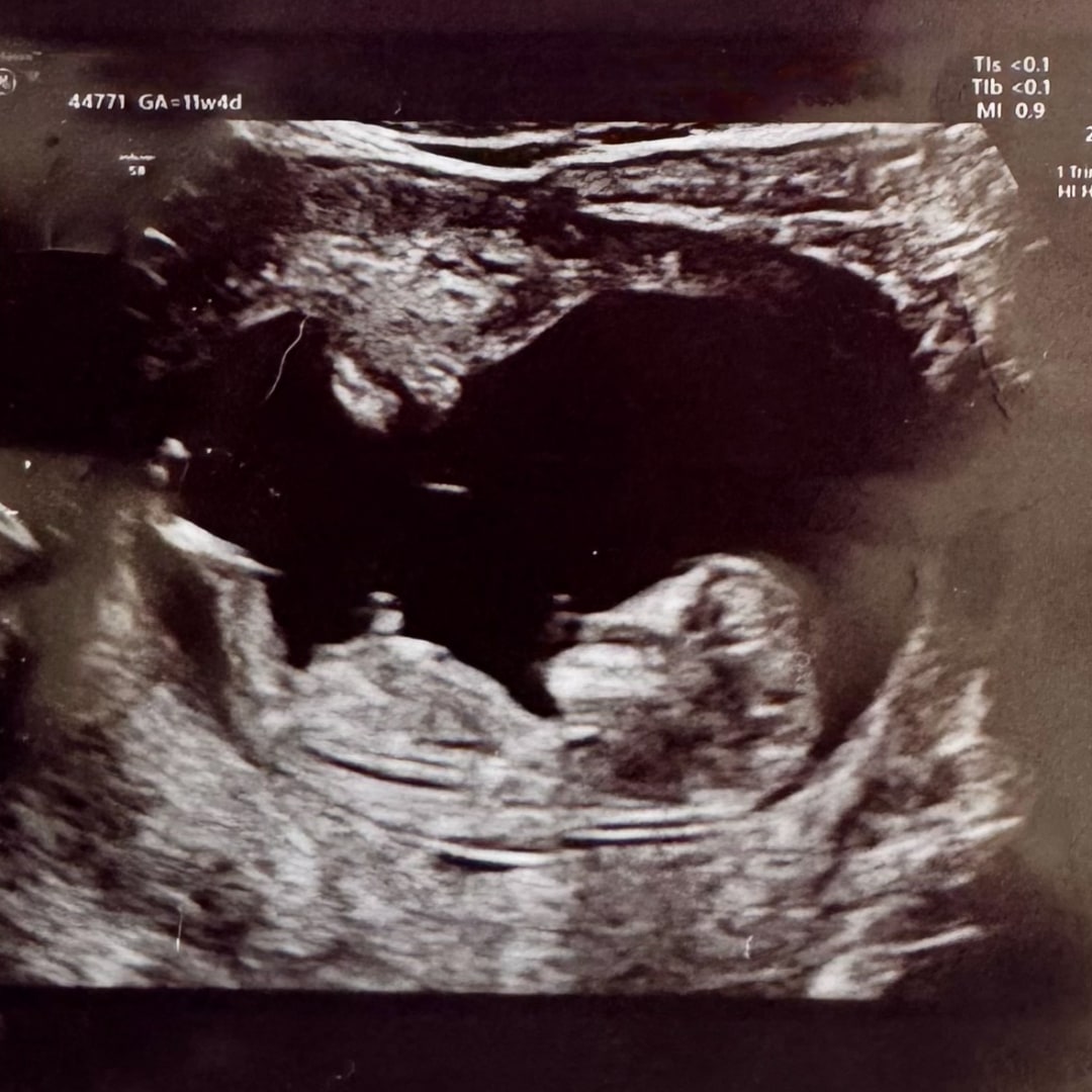 Photo shared by Aiesha for their Babylist baby registry.