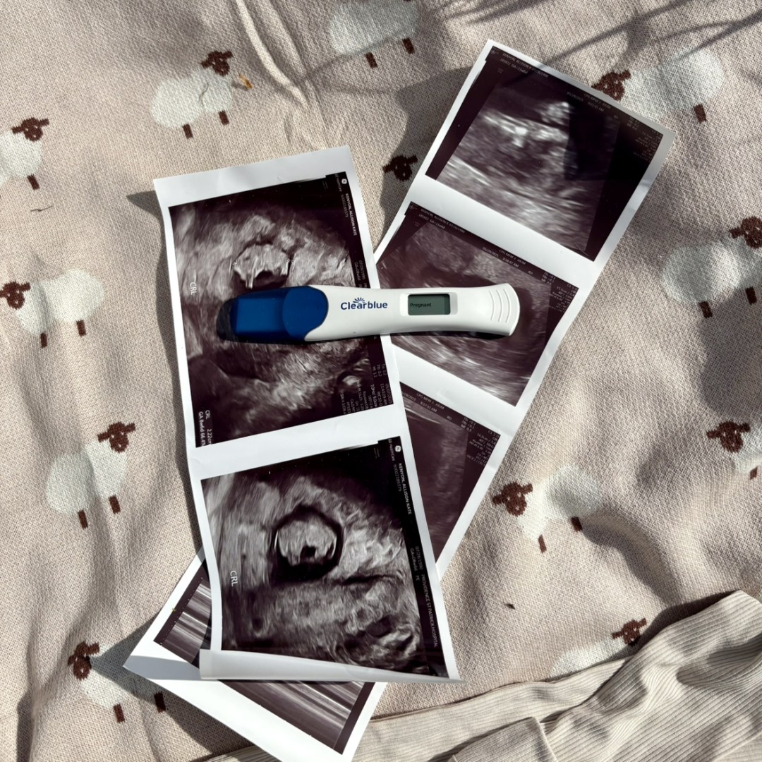 Photo shared by Alli for their Babylist baby registry.