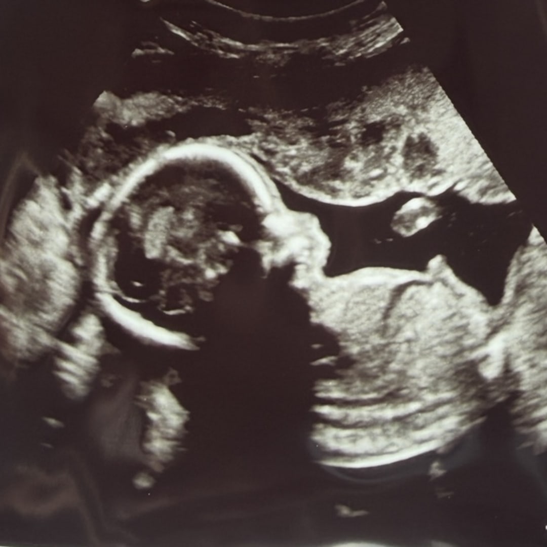 Photo shared by Victoria for their Babylist baby registry.
