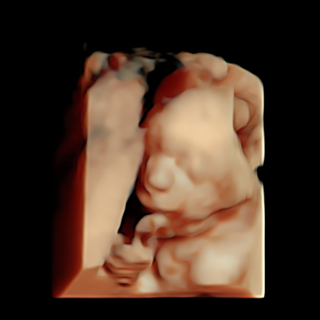 Photo shared by Lyiaih for their Babylist baby registry.