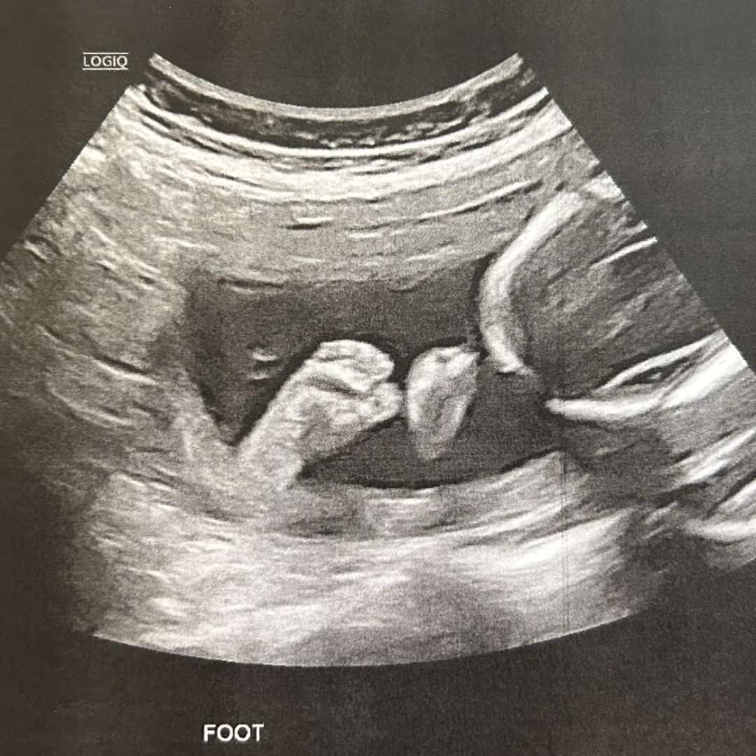 Photo shared by Gabriella for their Babylist baby registry.