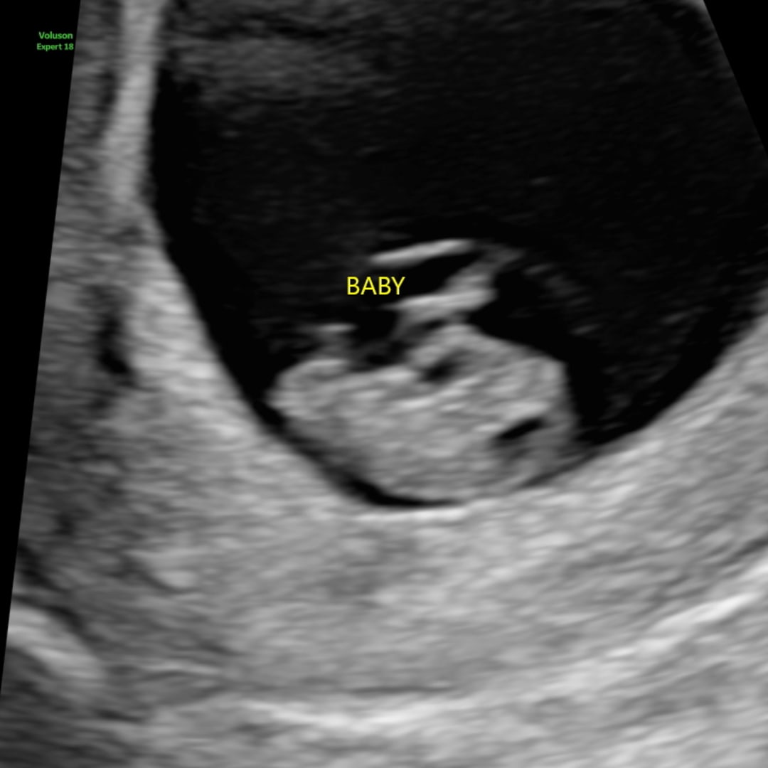 Photo shared by Eva for their Babylist baby registry.
