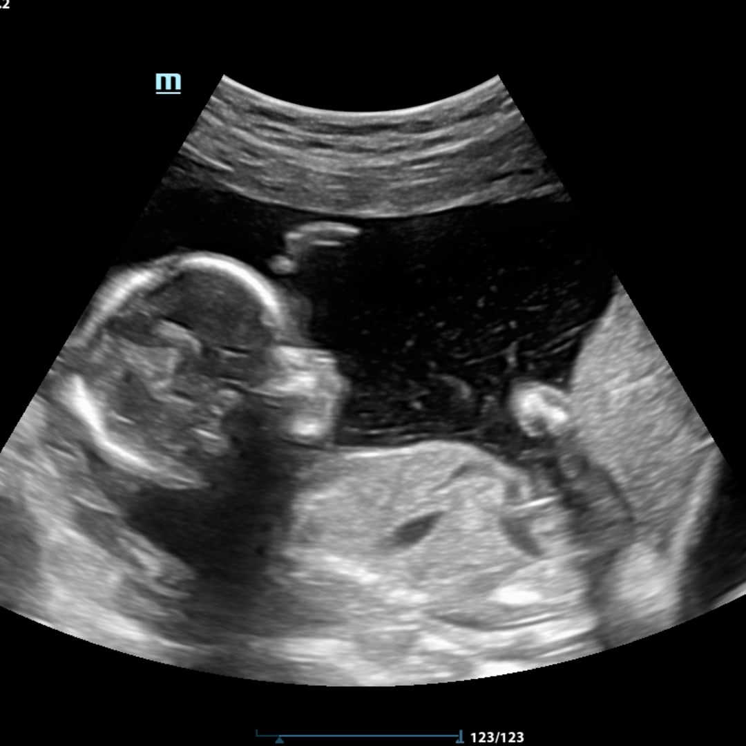 Photo shared by Innocence for their Babylist baby registry.