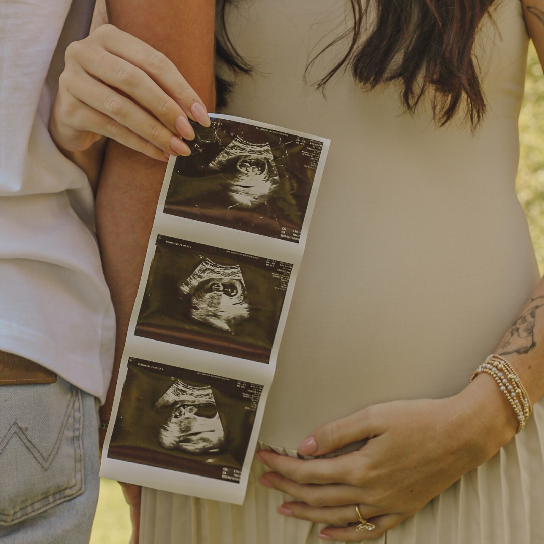 Photo shared by Hanna for their Babylist baby registry.