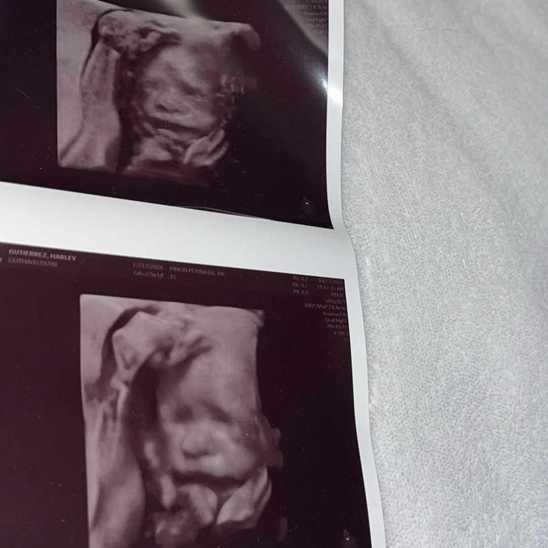 Photo shared by Harley for their Babylist baby registry.