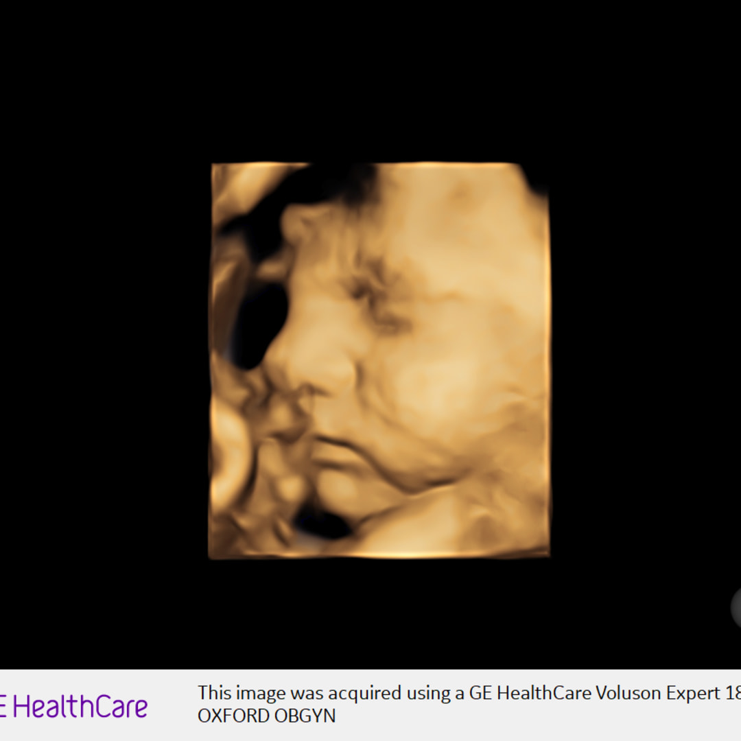 Photo shared by Brinley for their Babylist baby registry.