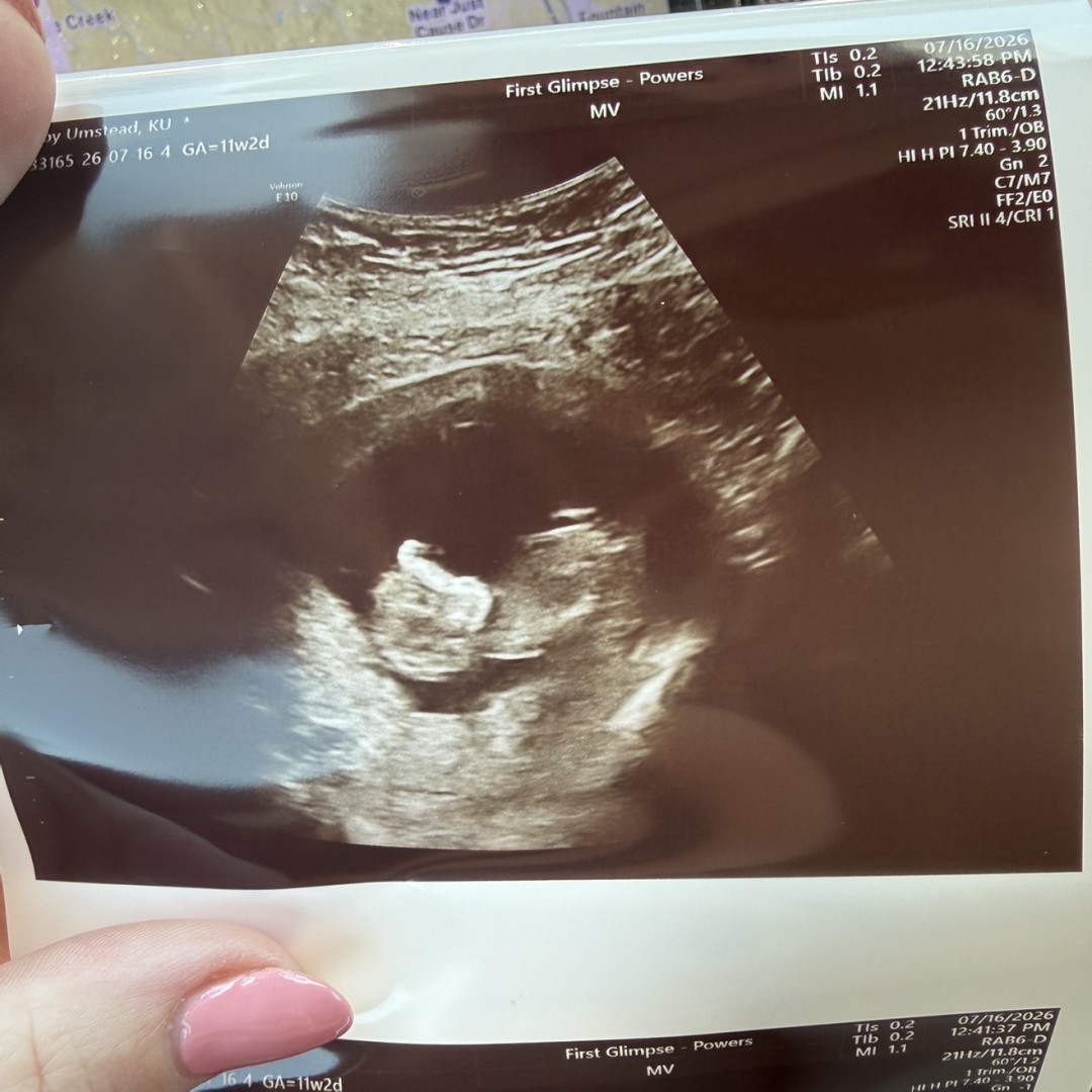 Photo shared by Emily for their Babylist baby registry.