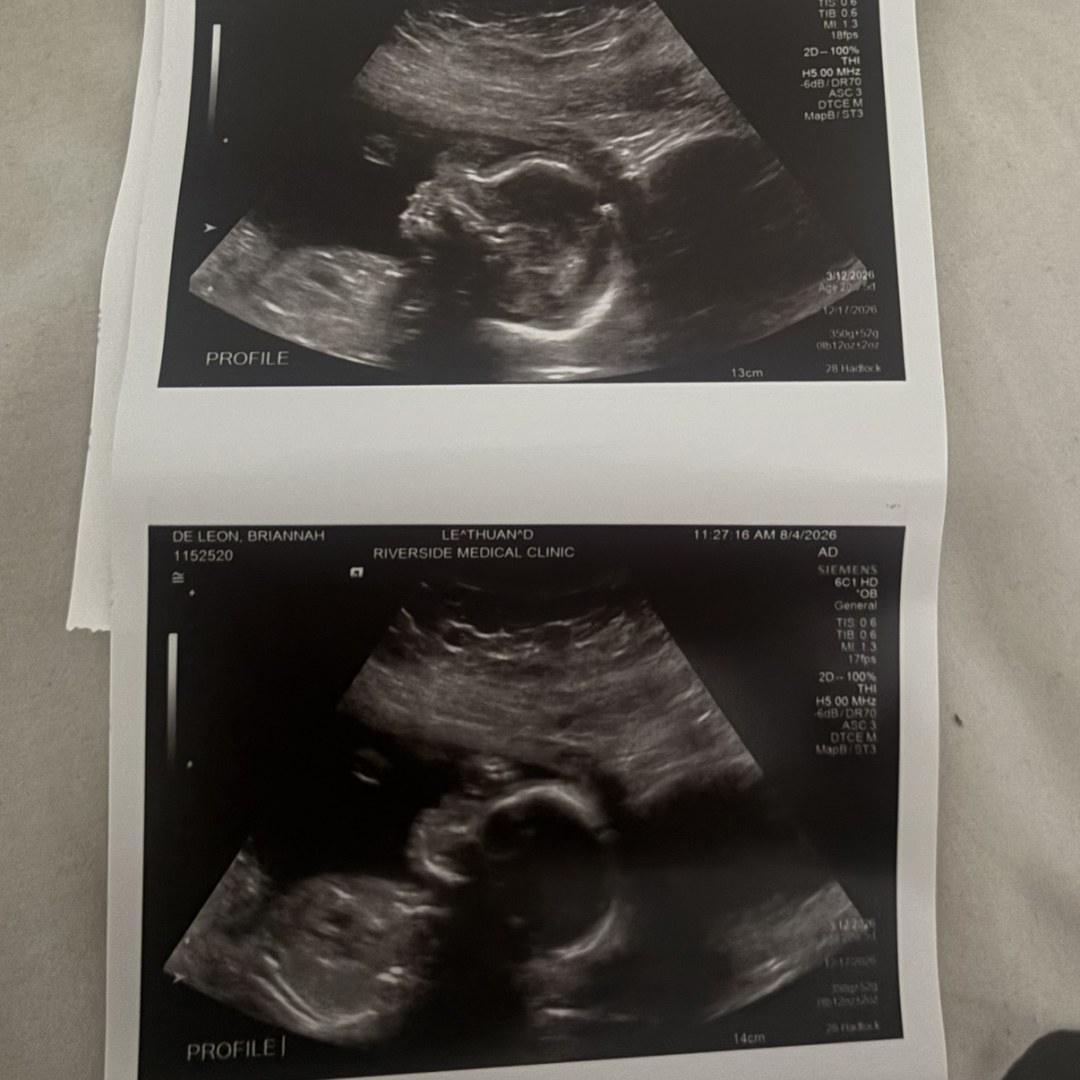 Photo shared by Briannah for their Babylist baby registry.