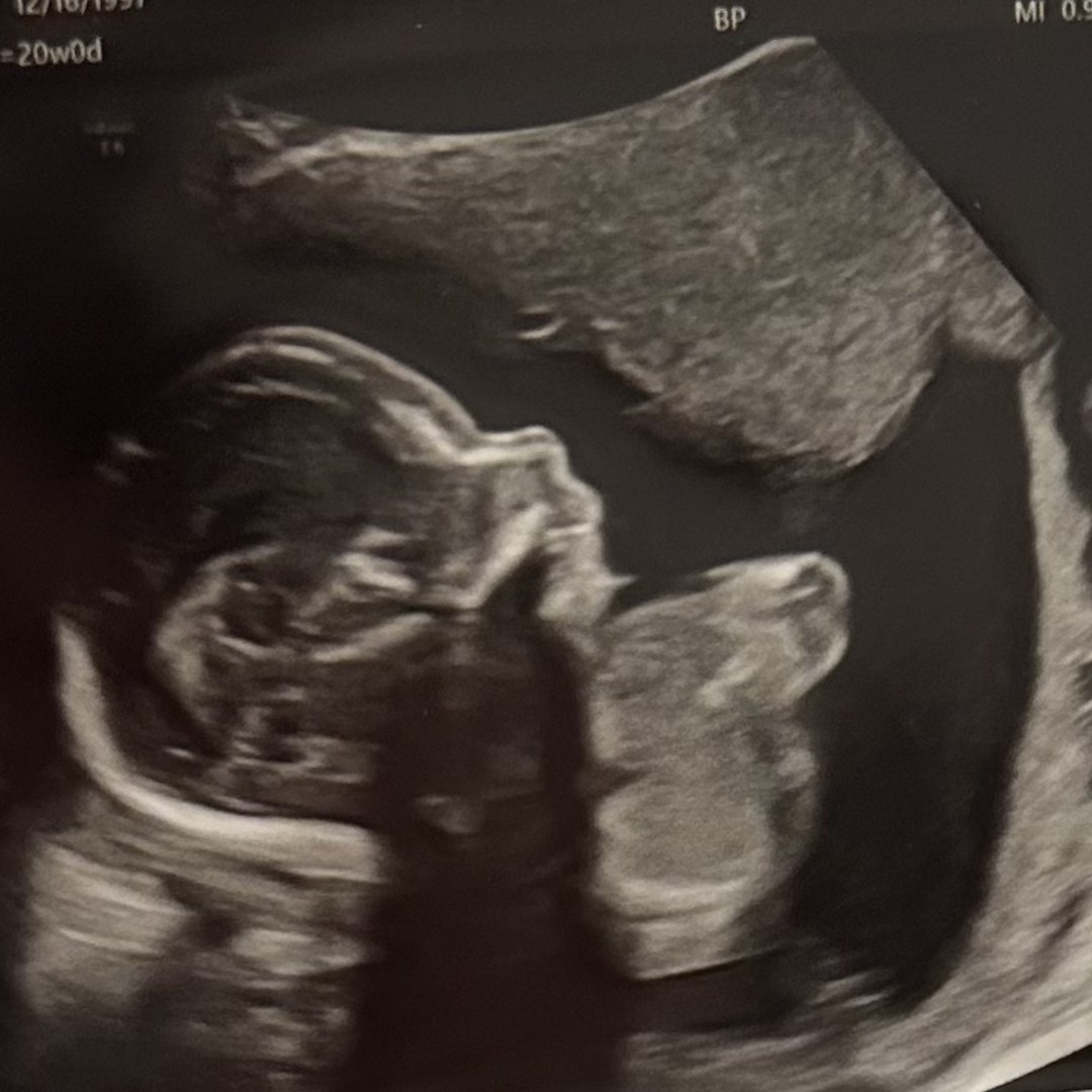 Photo shared by Lainey for their Babylist baby registry.