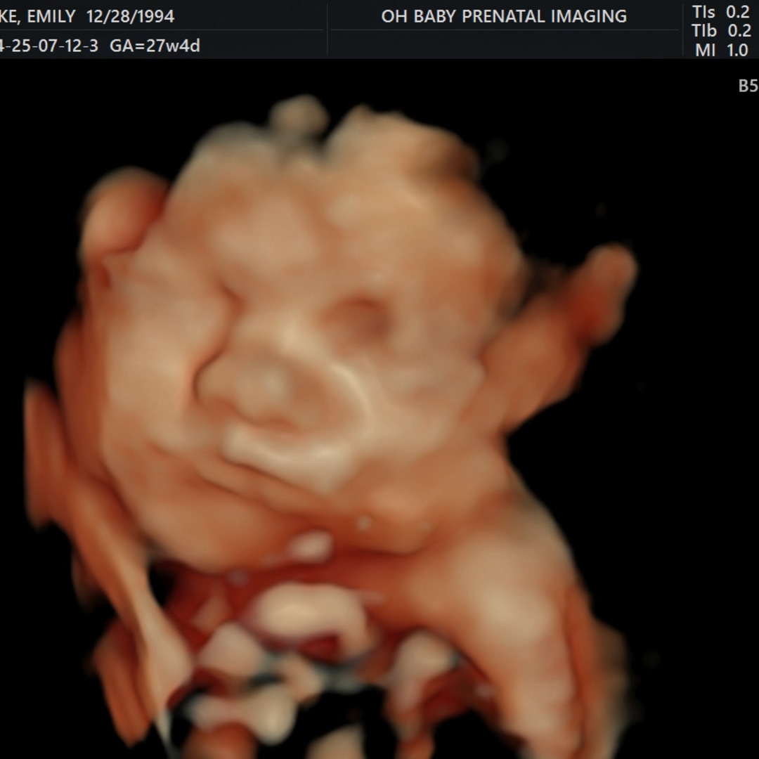Photo shared by Emily for their Babylist baby registry.