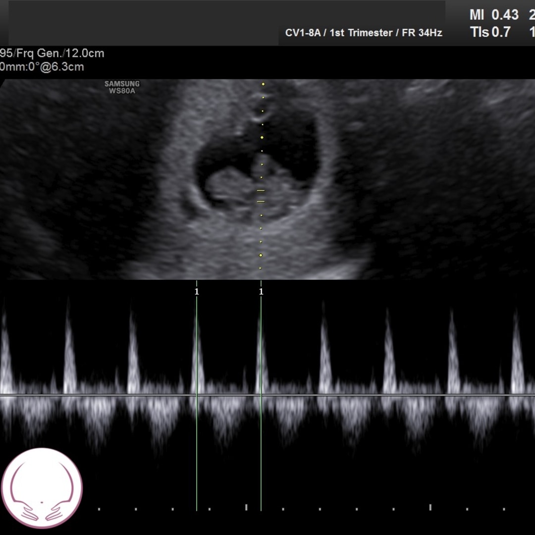 Photo shared by Natalie for their Babylist baby registry.