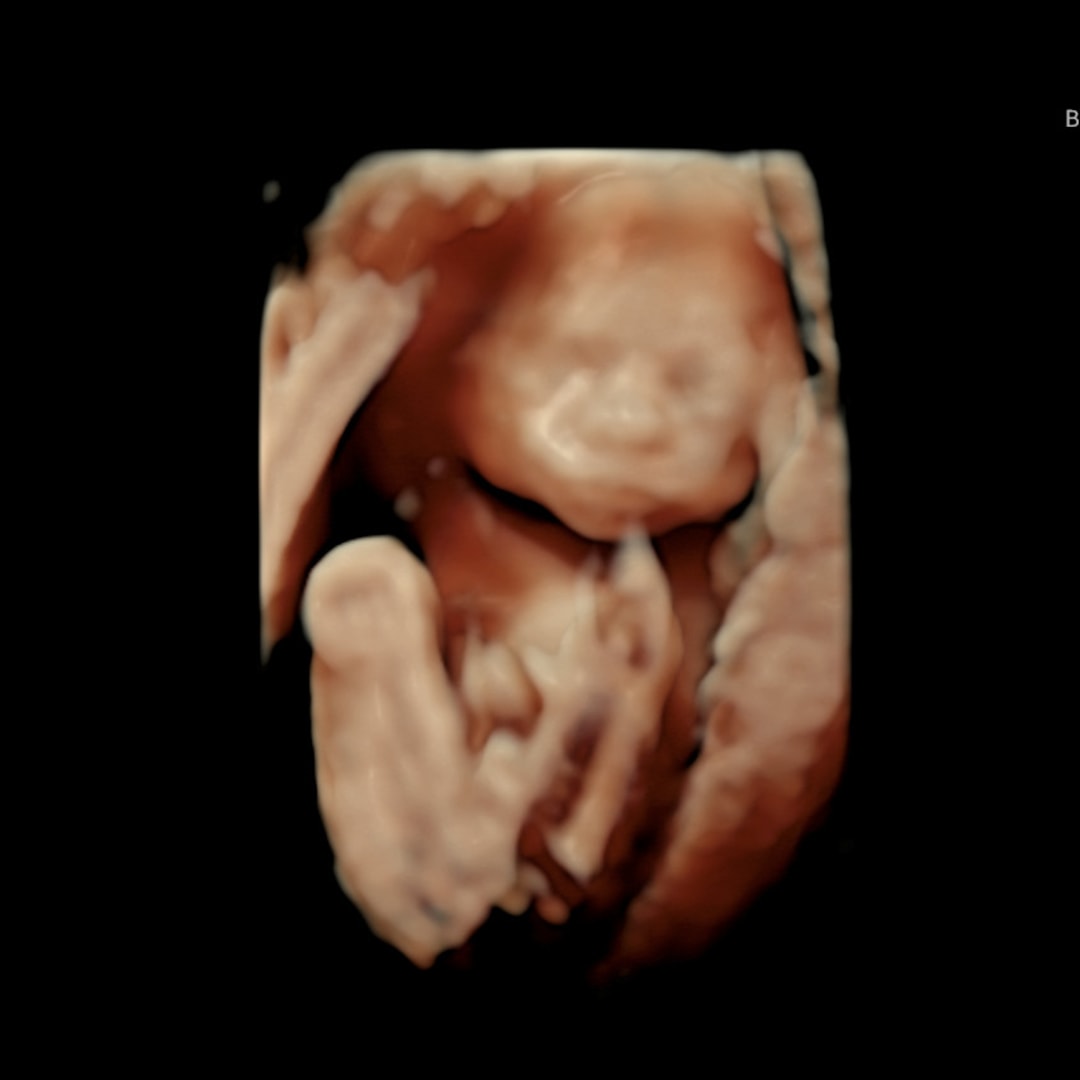 Photo shared by Taylor for their Babylist baby registry.