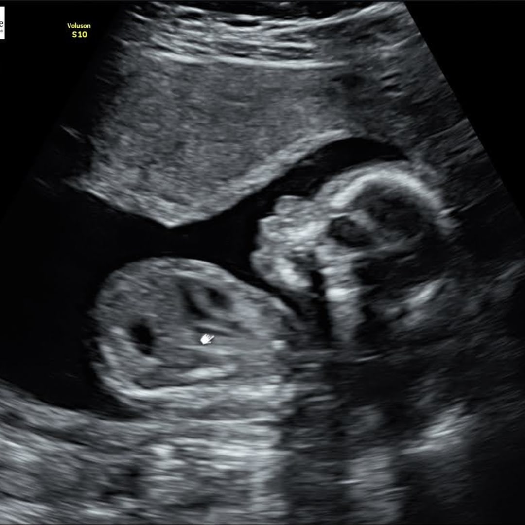 Photo shared by Anya for their Babylist baby registry.