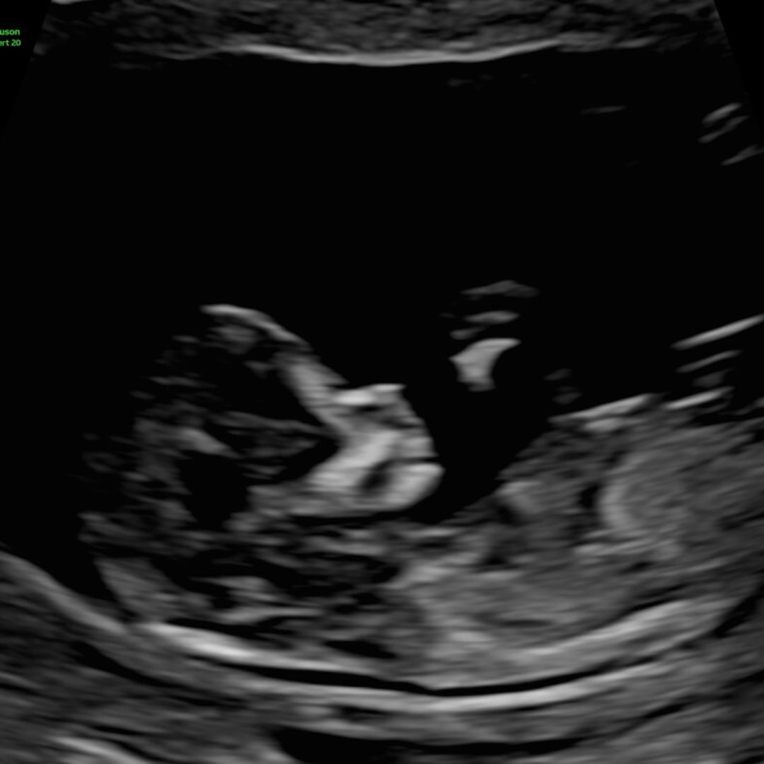 Photo shared by Angie for their Babylist baby registry.