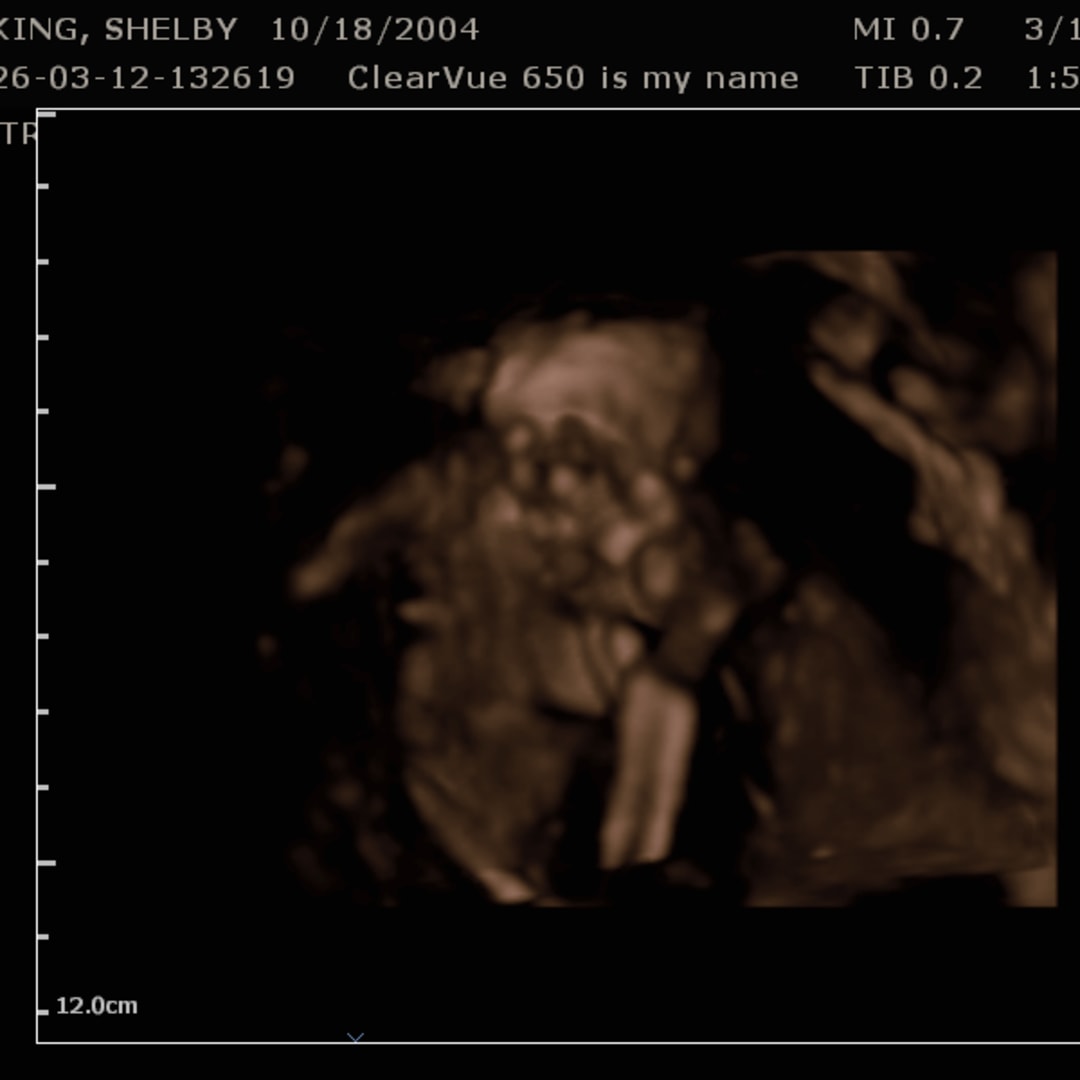 Photo shared by Shelby for their Babylist baby registry.