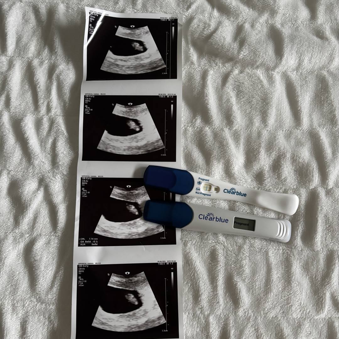 Photo shared by Hannah for their Babylist baby registry.