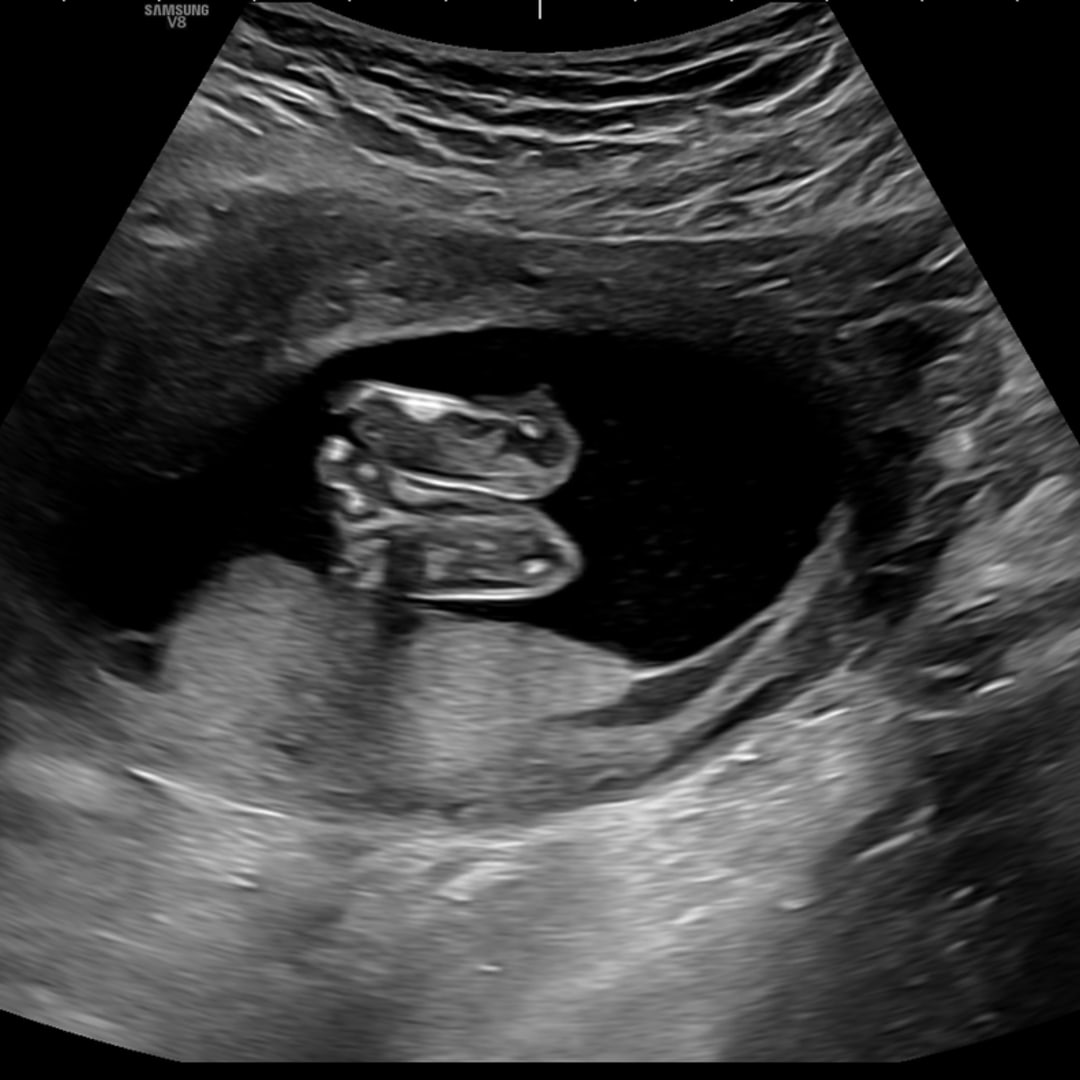 Photo shared by Elyse for their Babylist baby registry.