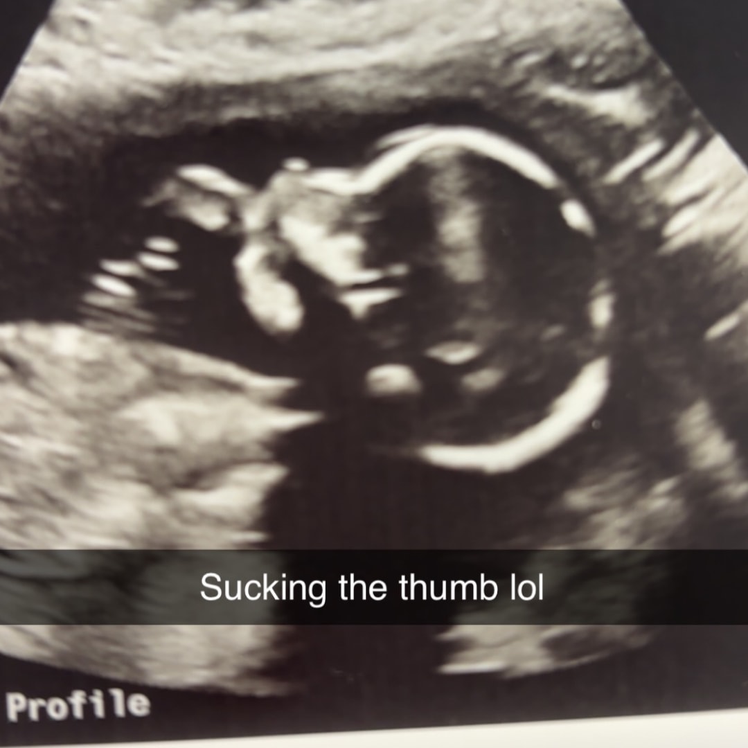 Photo shared by Abigail for their Babylist baby registry.