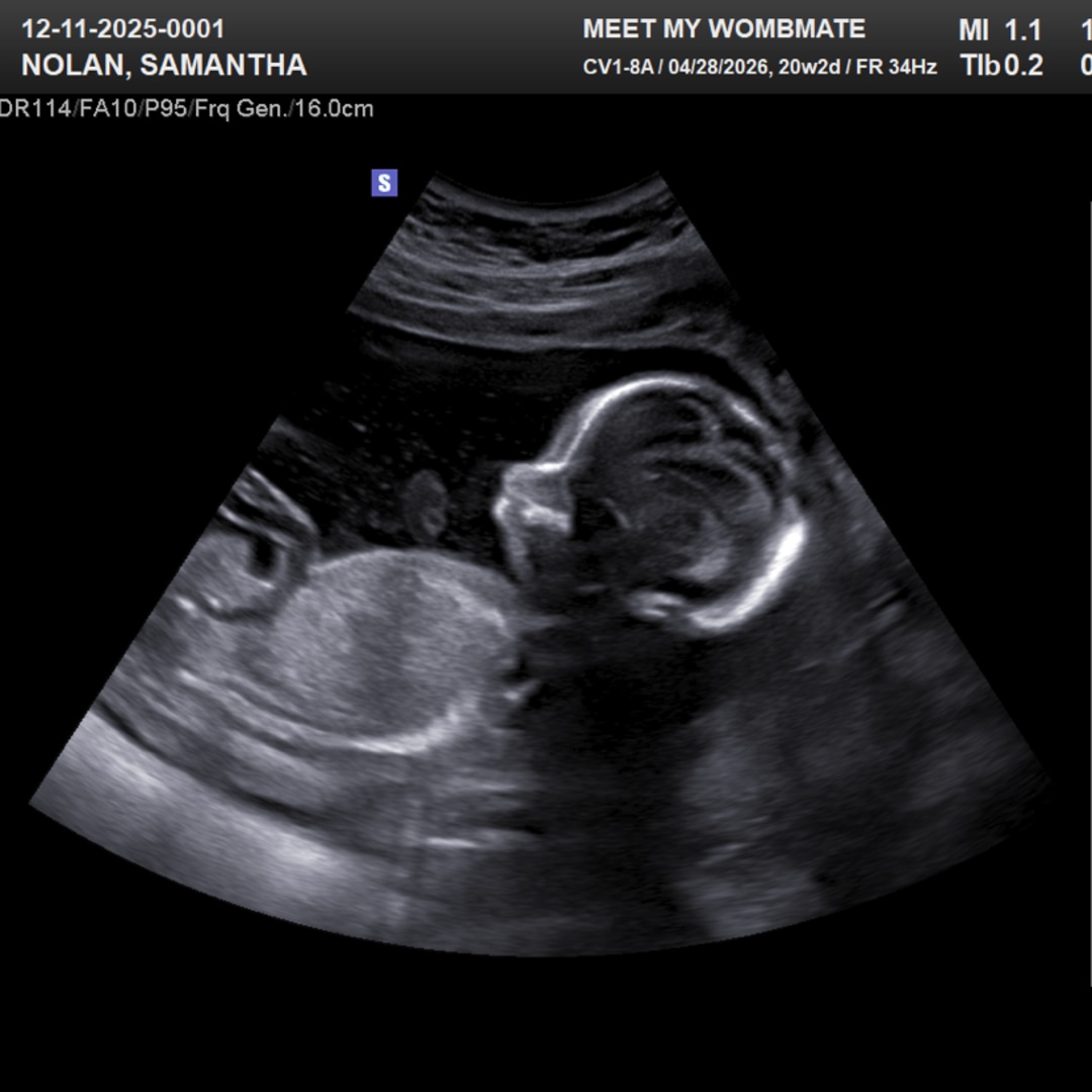 Photo shared by Samantha for their Babylist baby registry.