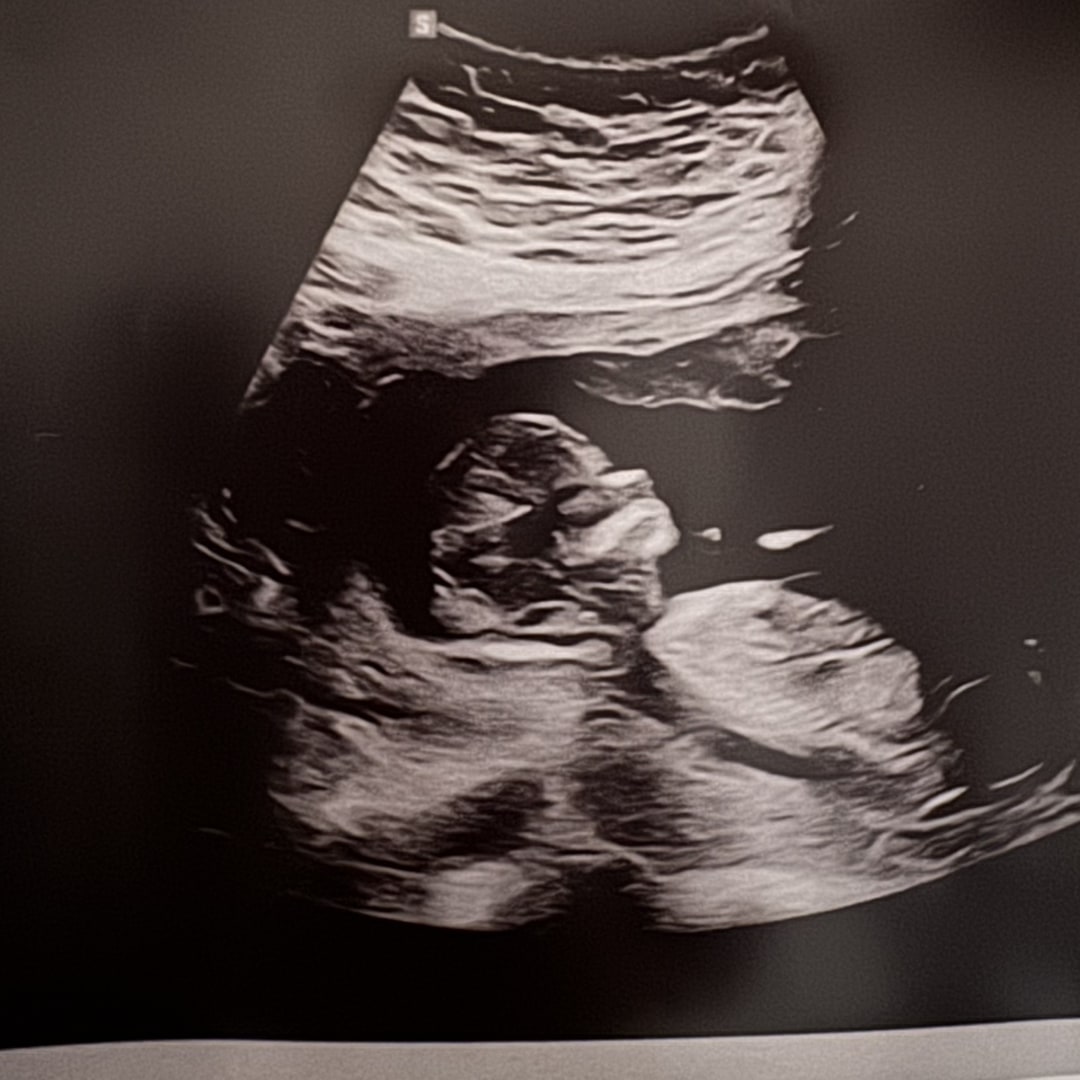 Photo shared by Dearbhla for their Babylist baby registry.