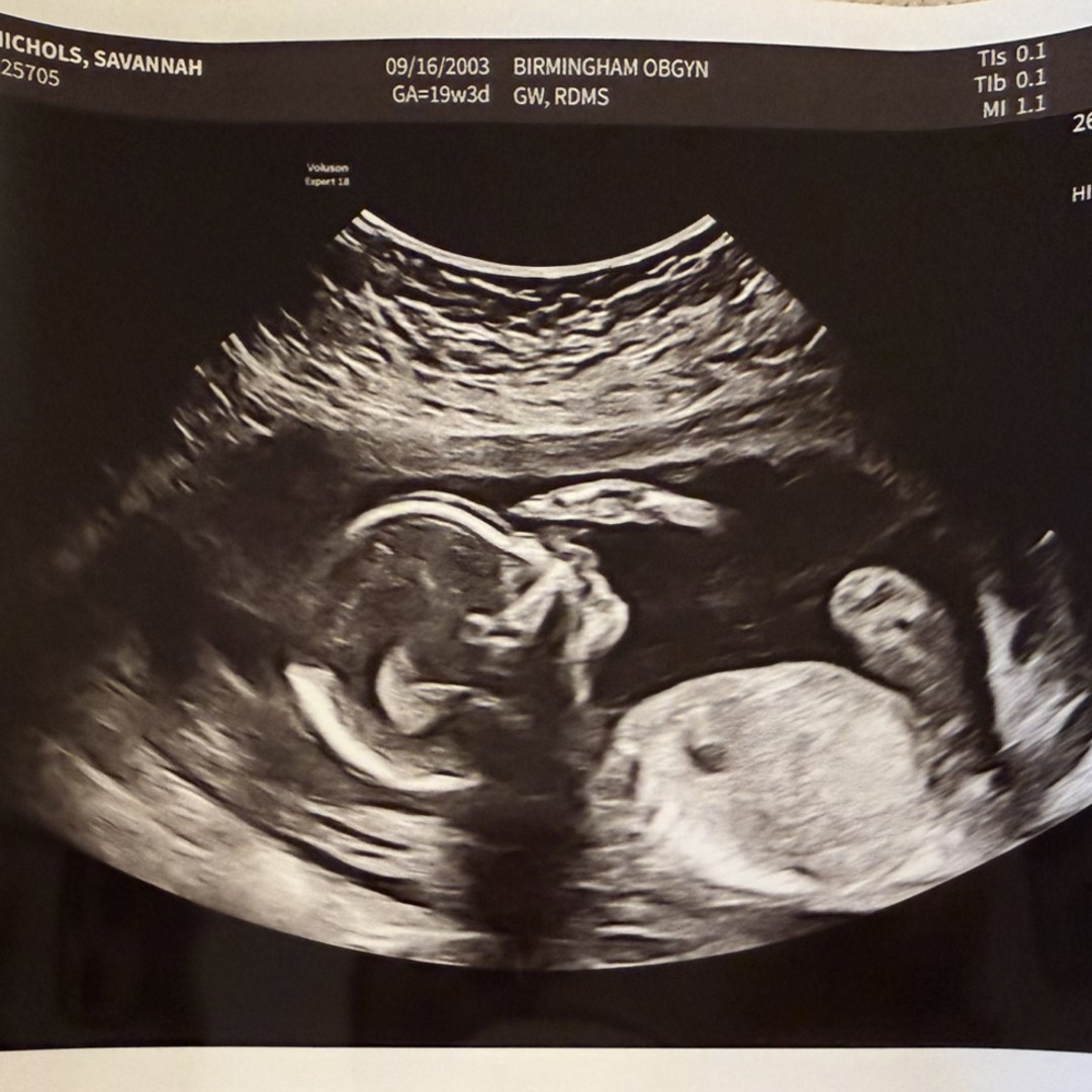 Photo shared by Savannah for their Babylist baby registry.