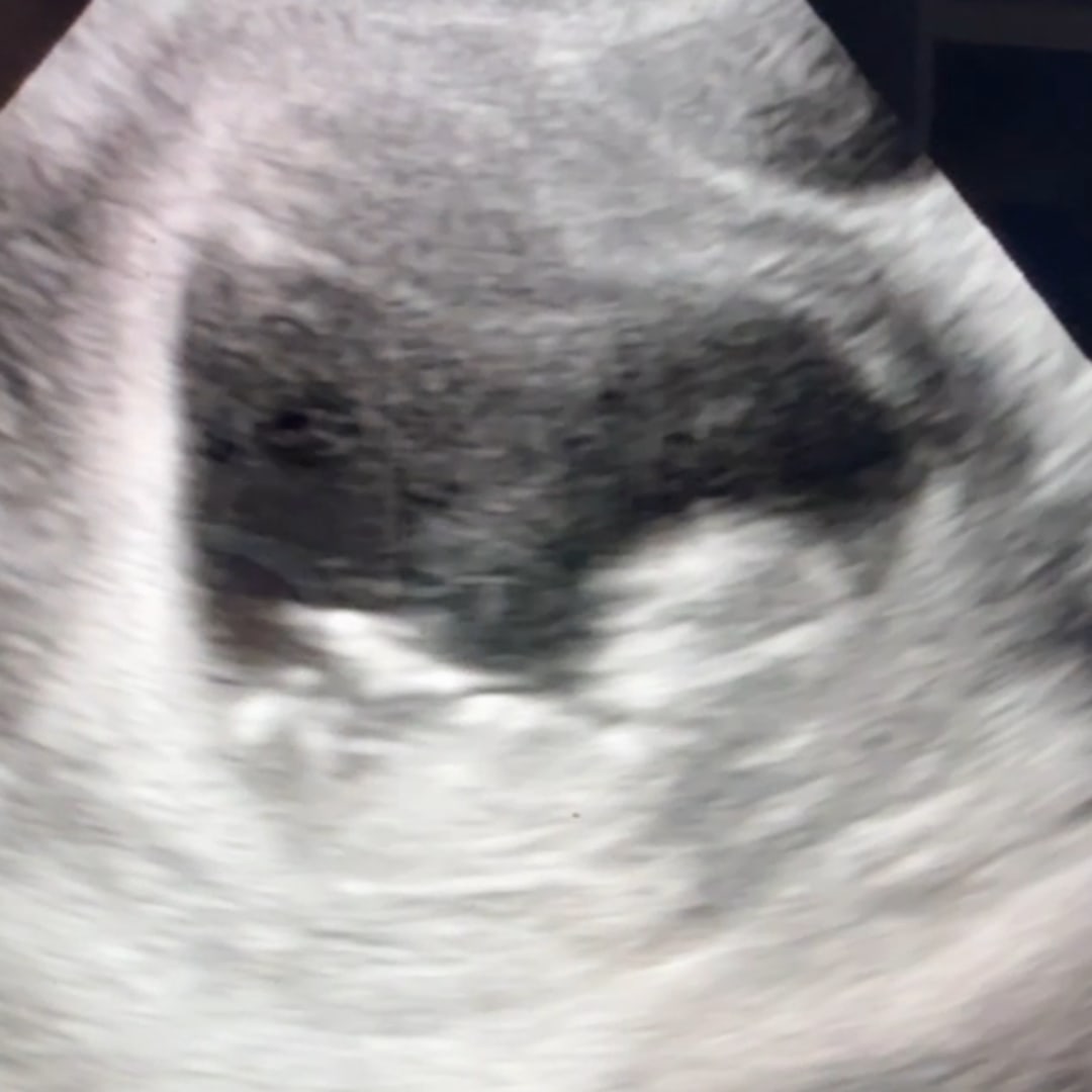 Photo shared by Erin for their Babylist baby registry.
