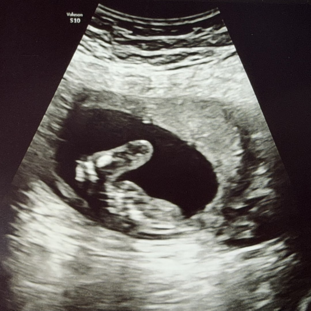 Photo shared by Mexia for their Babylist baby registry.