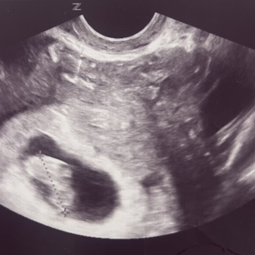 Photo shared by Ana for their Babylist baby registry.