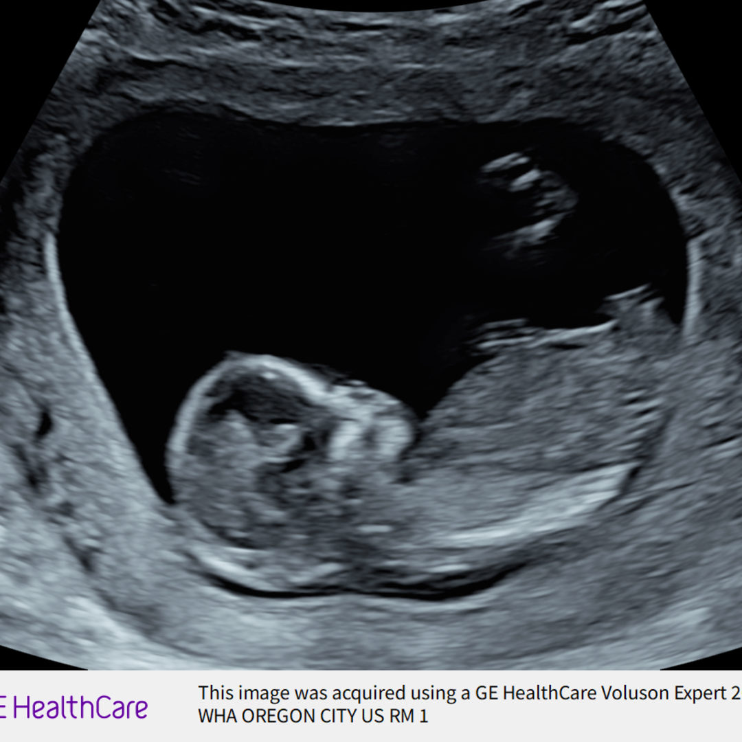 Photo shared by Stephanie for their Babylist baby registry.