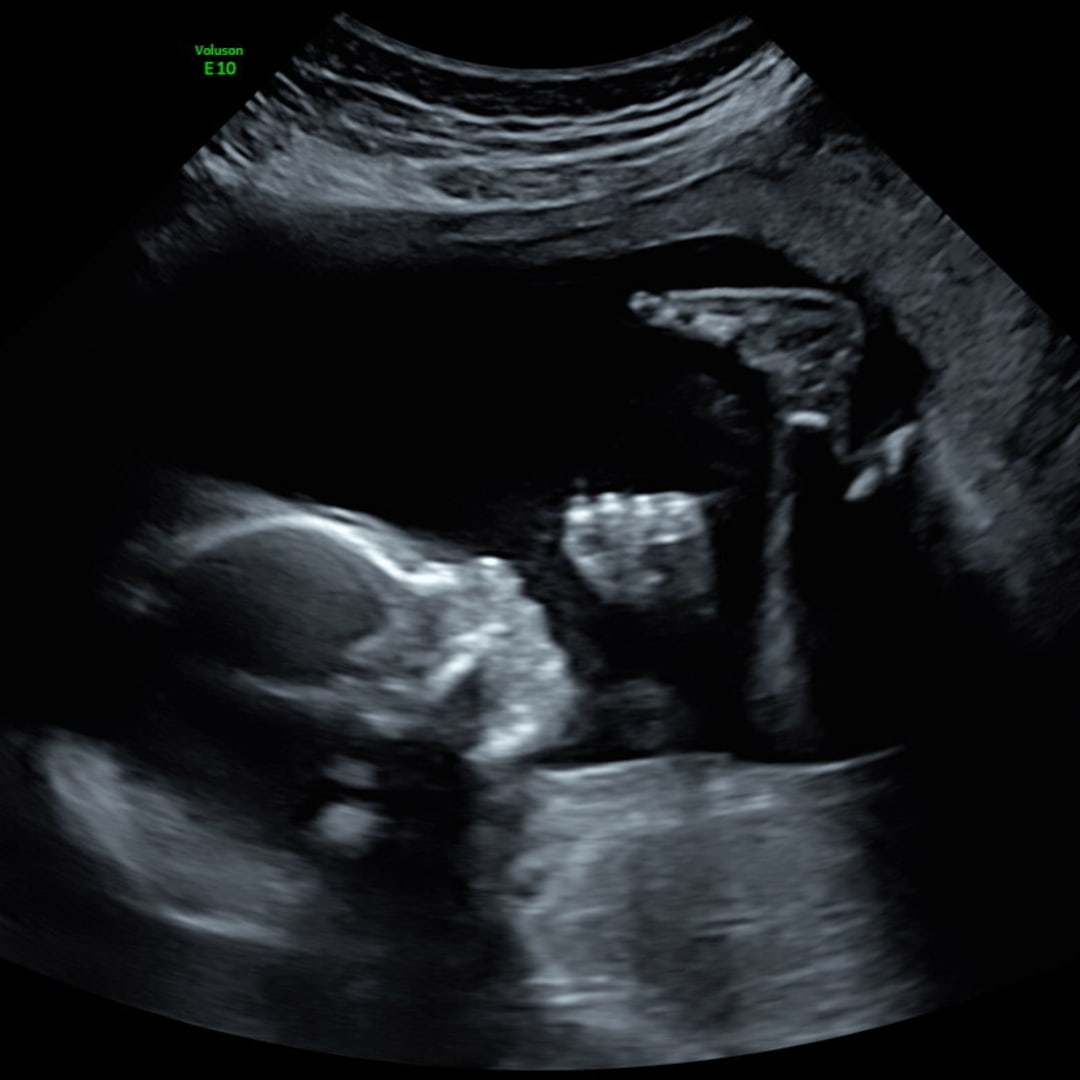 Photo shared by Rochelle for their Babylist baby registry.