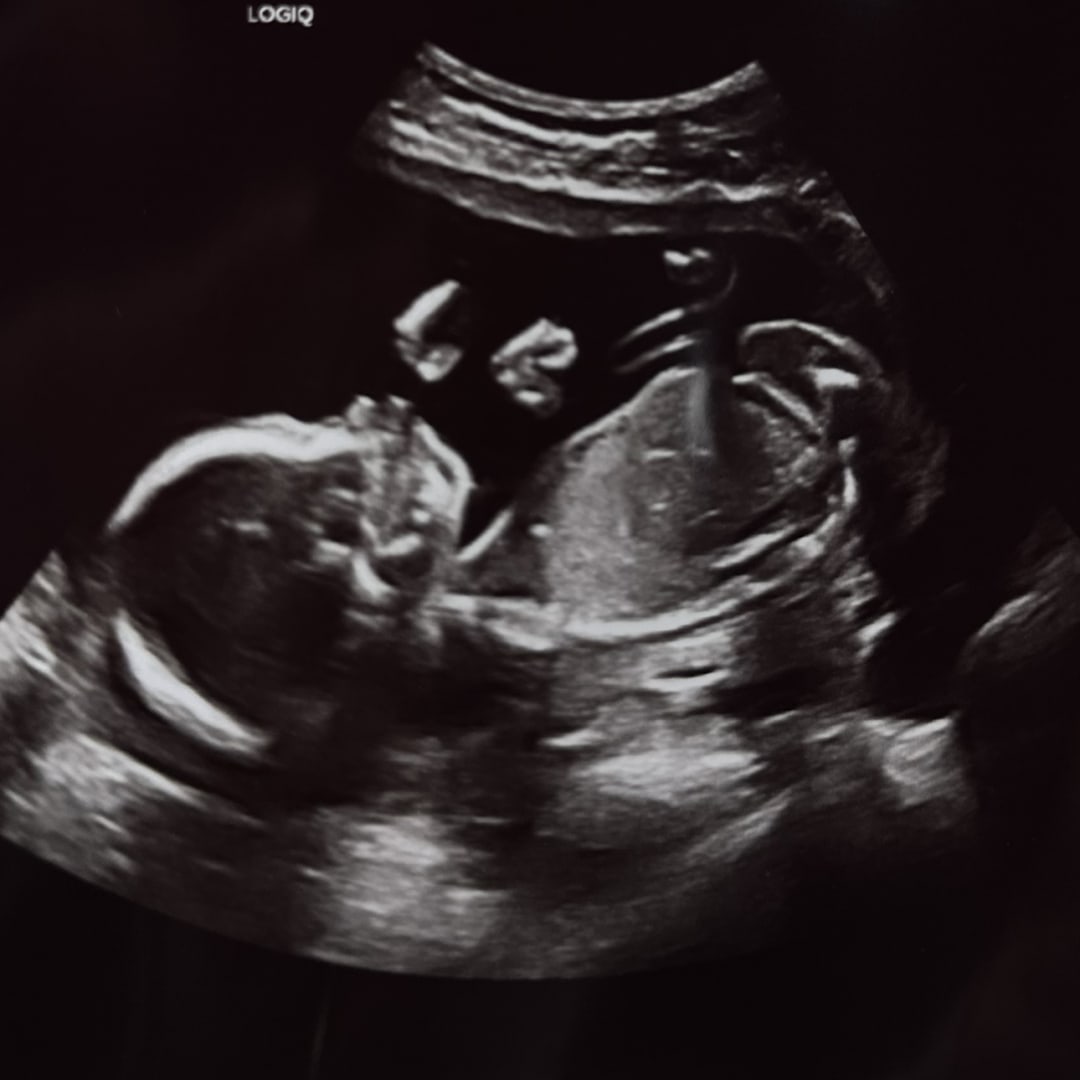 Photo shared by Danna for their Babylist baby registry.