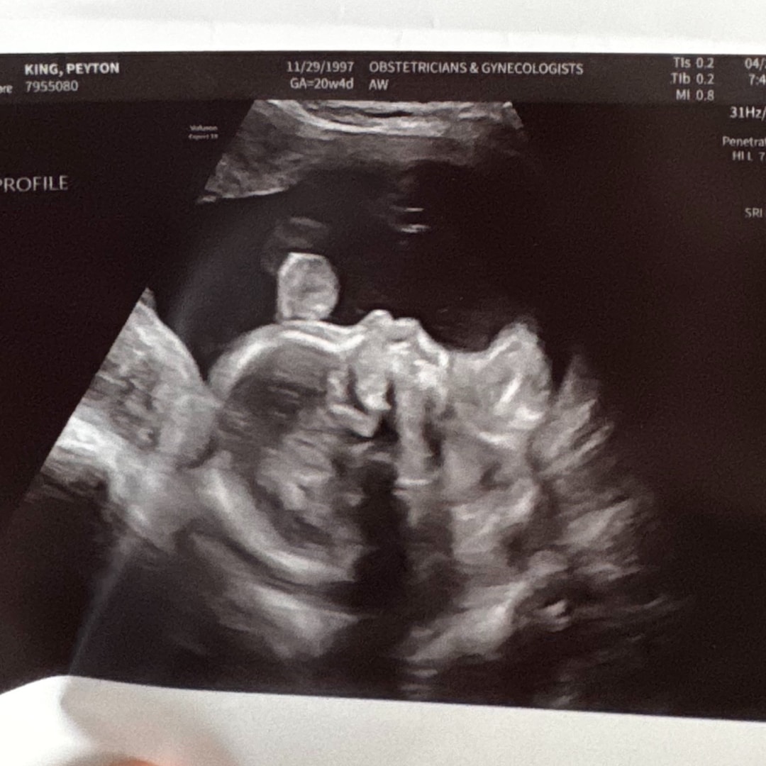 Photo shared by Peyton for their Babylist baby registry.