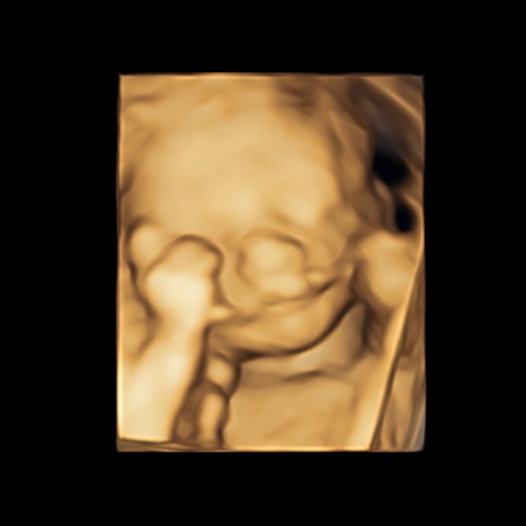 Photo shared by Eliza for their Babylist baby registry.