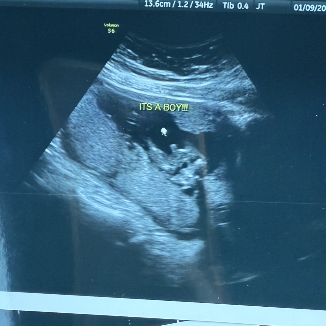 Photo shared by Abbi for their Babylist baby registry.