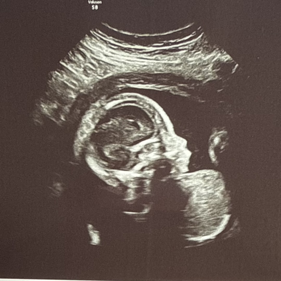 Photo shared by Brianna for their Babylist baby registry.