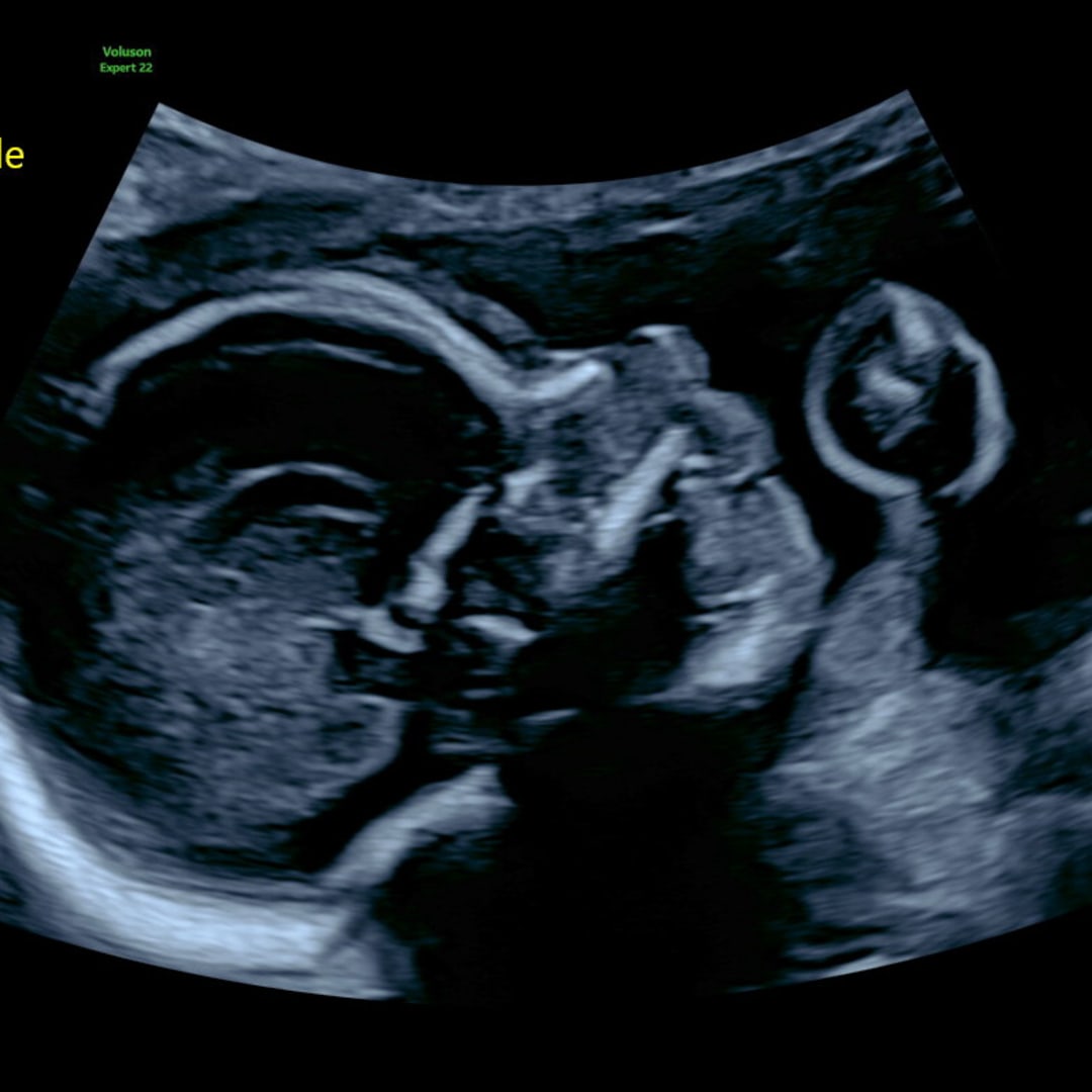 Photo shared by Emery for their Babylist baby registry.