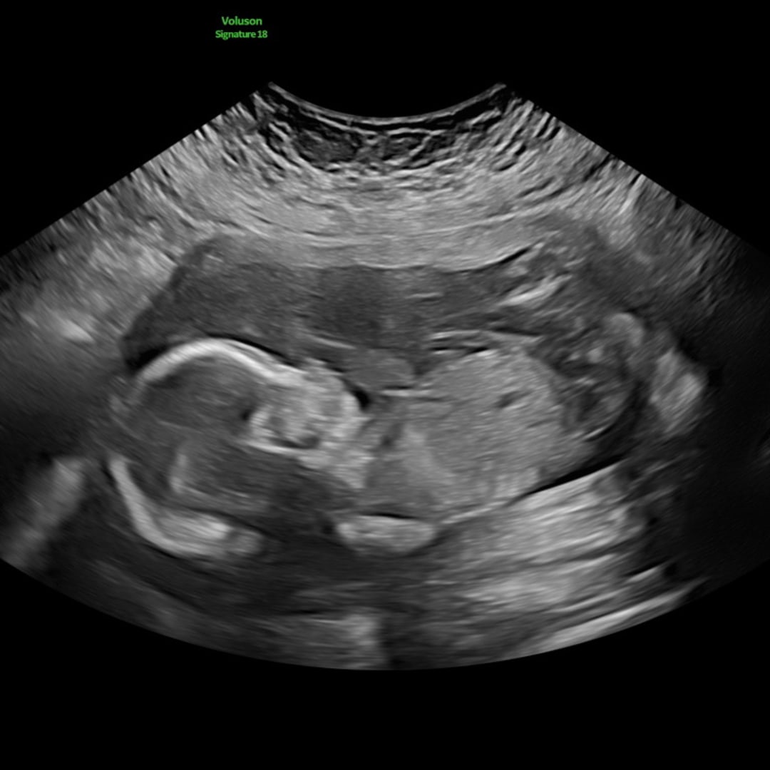 Photo shared by Harper for their Babylist baby registry.