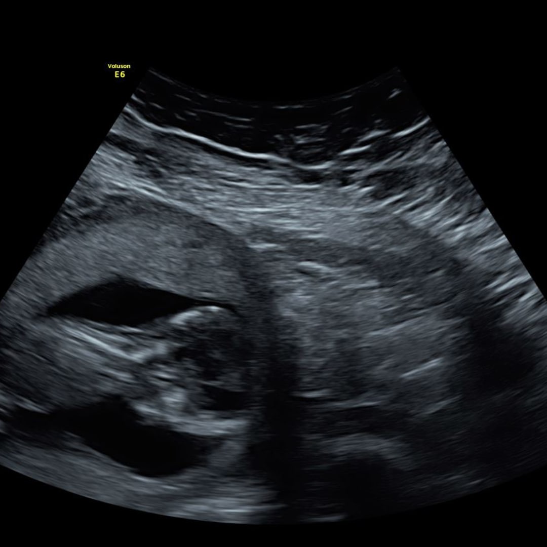 Photo shared by Kayla for their Babylist baby registry.