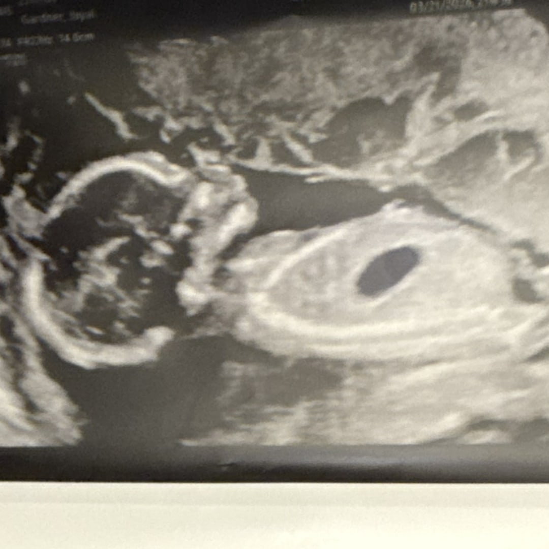 Photo shared by Jayai for their Babylist baby registry.