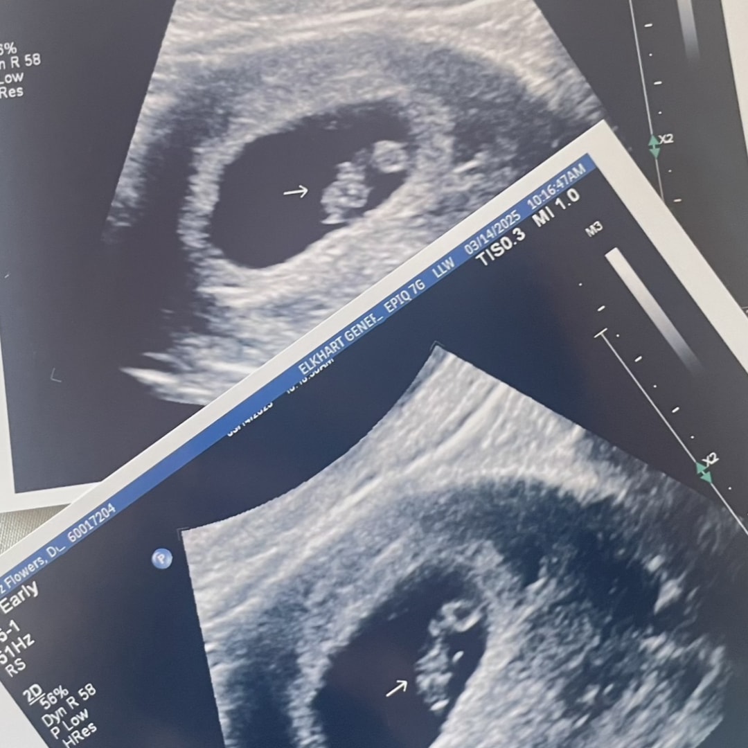 Photo shared by Lailani for their Babylist baby registry.