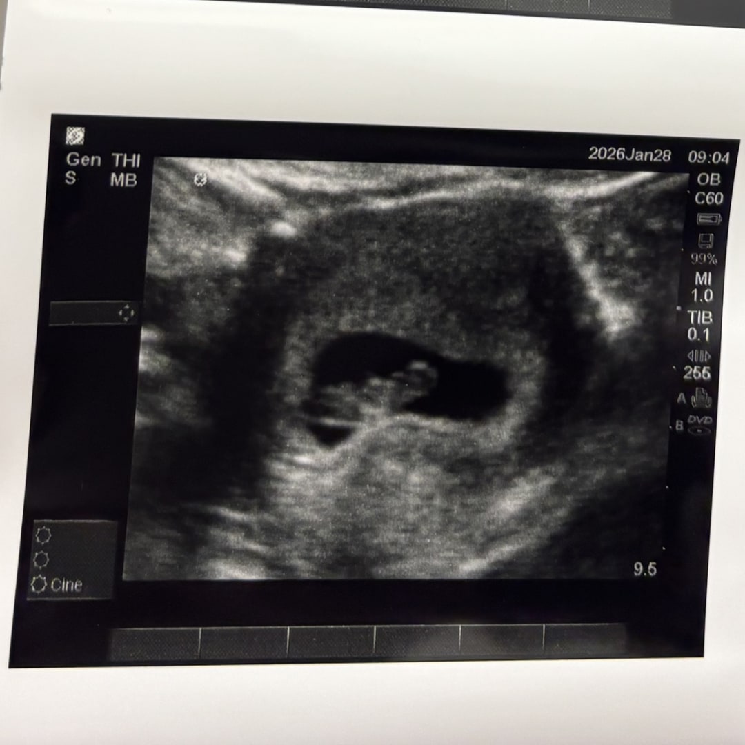 Photo shared by Tori for their Babylist baby registry.