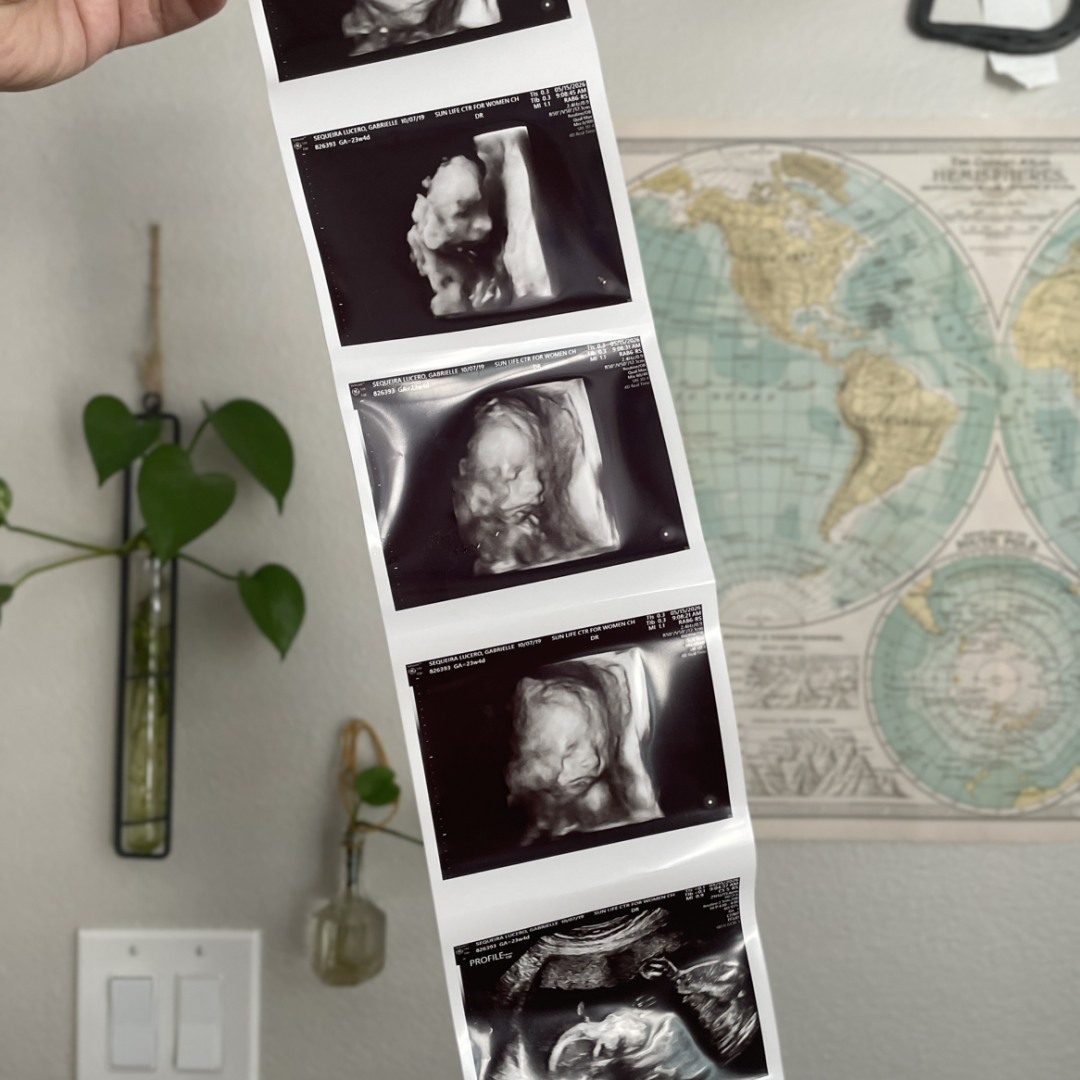 Photo shared by Gabby for their Babylist baby registry.