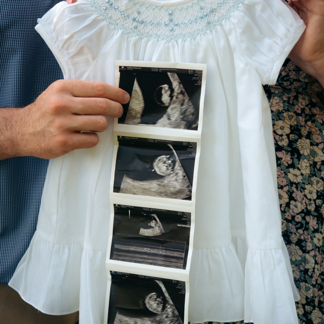 Photo shared by Bethany for their Babylist baby registry.
