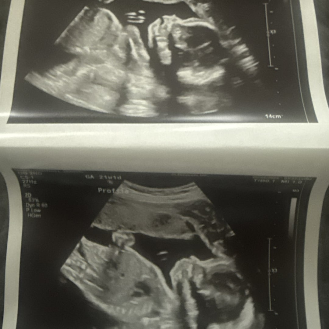 Photo shared by Christina for their Babylist baby registry.