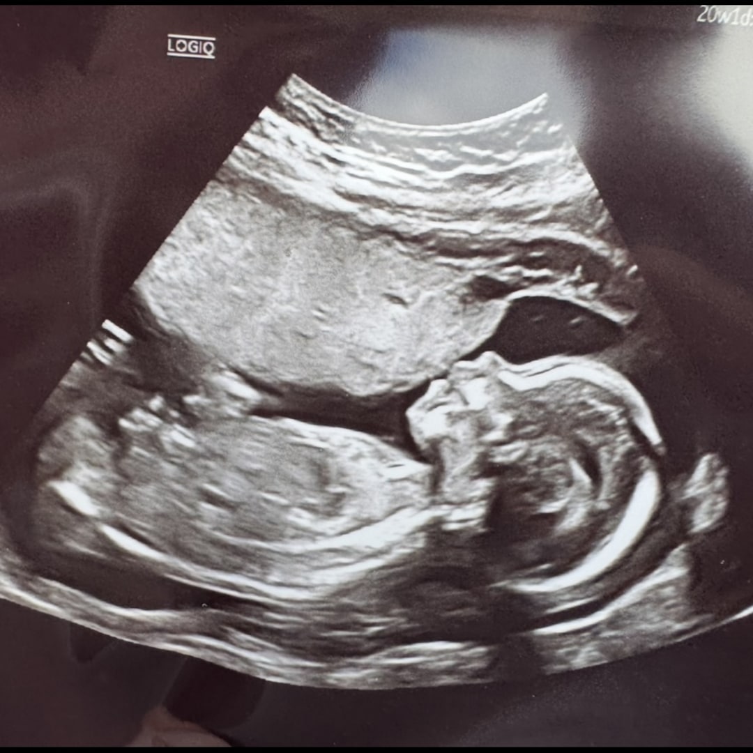 Photo shared by Abby for their Babylist baby registry.